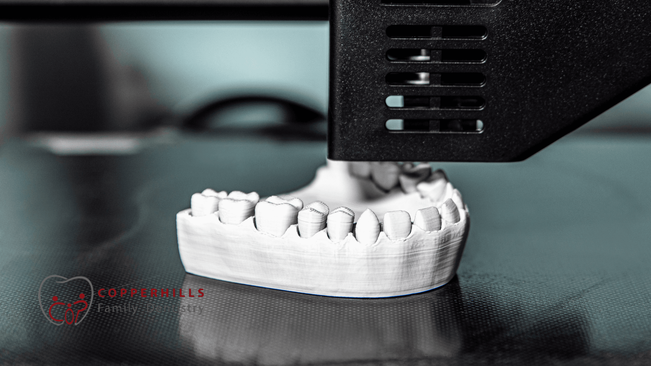 The Role of 3D Printing in Modern Dentistry
