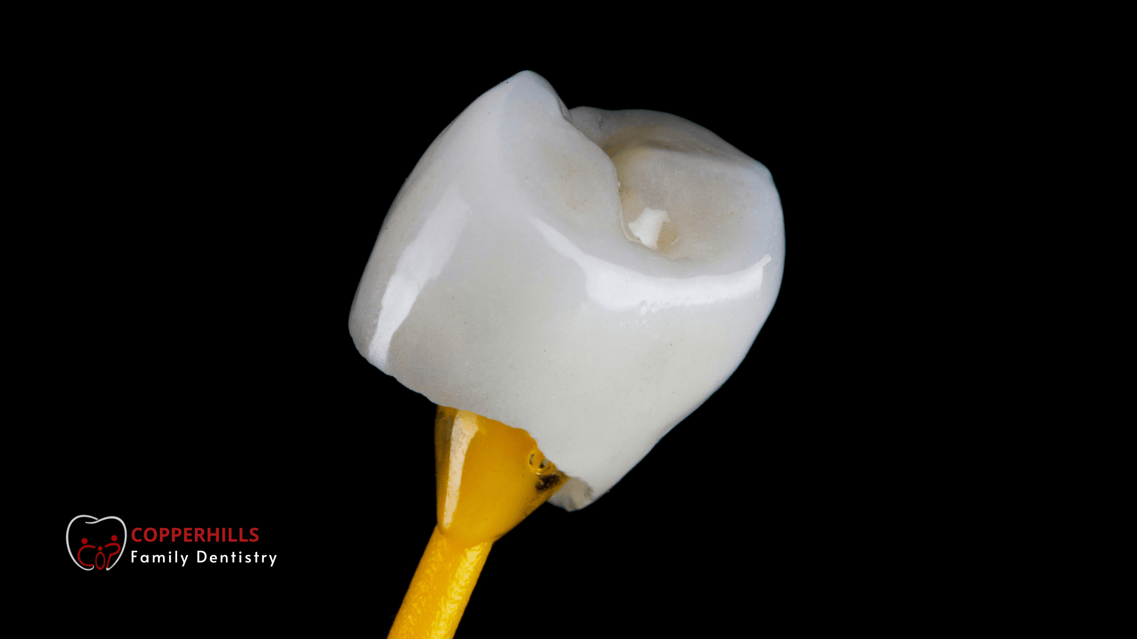 How to Care for Your Dental Crown