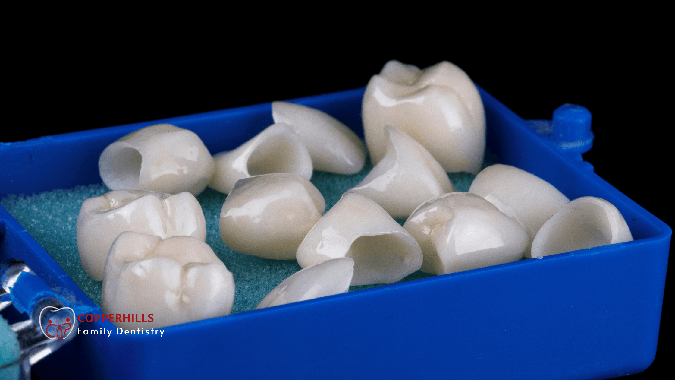 dental-crown-vs-filling