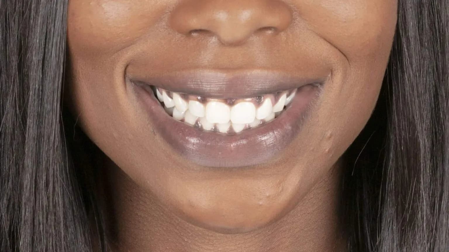 Black Gums